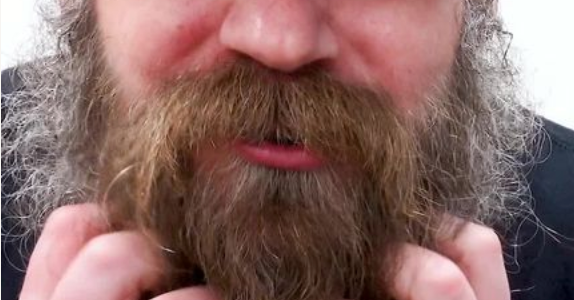 bearded man itching sensitive skin