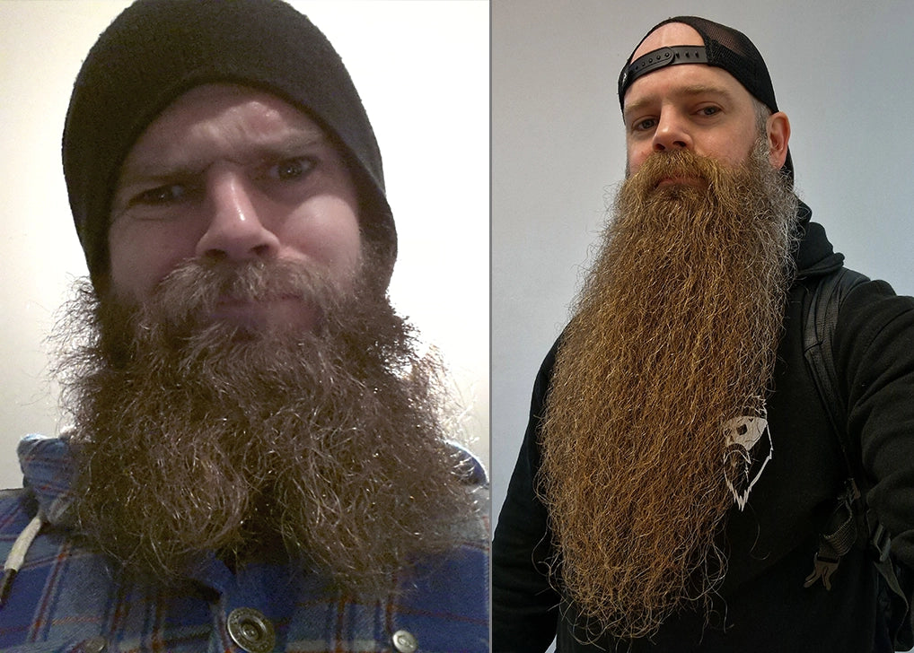 How to Train Your Beard to Grow Down