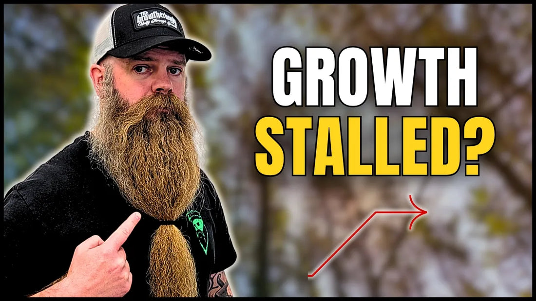 Why Has My Beard Stopped Improving?