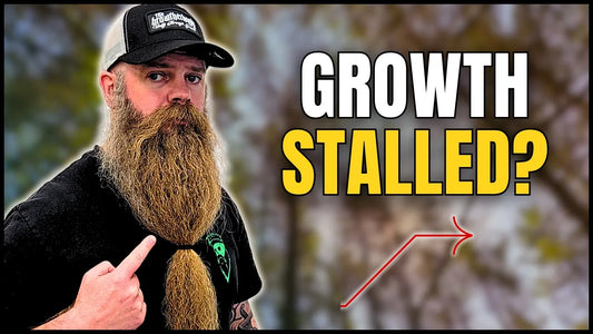 Why Has My Beard Stopped Improving?