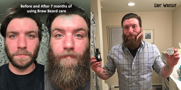 Uneven Beard Growth. How To Avoid It And Get Results